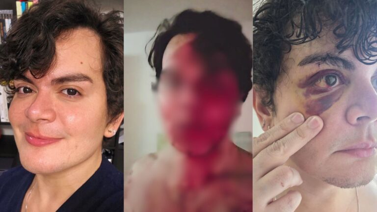 Médico agredido em Recife denuncia homofobia após invasão de apartamento