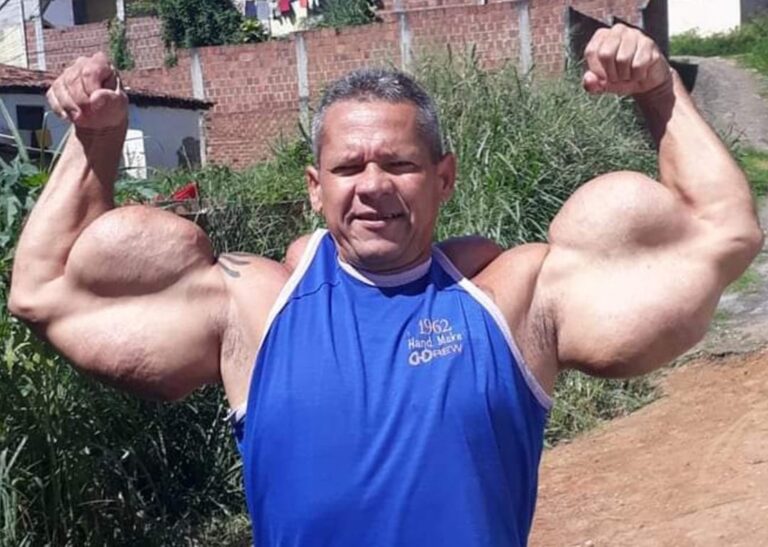 Morte de Arlindo Anomalia, o 'Popeye Brasileiro', aos 55 anos choca comunidade
