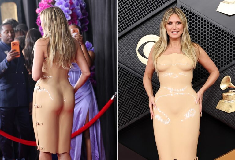 Heidi Klum Exibe Hematomas Causados por Vestido de Látex no Grammy 2026