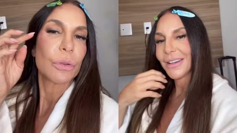 Ivete Sangalo Fala Sobre Sintomas Após Cirurgia Facial: 'Um Pouco de Dormência'